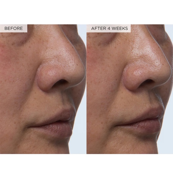 New!Alia Bhatt’s Fav The Glow Recipe Watermelon Glow PHA+BHA Pore-Tight Toner - Picture 3 of 9